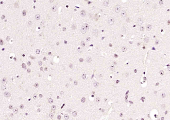 PPP1CA Rabbit Polyclonal Antibody
