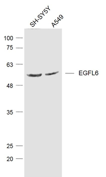 EGFL6 Rabbit Polyclonal Antibody