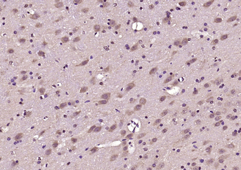 RIM2 Rabbit Polyclonal Antibody