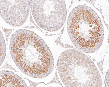 Aurora A Recombinant Rabbit Monoclonal Antibody