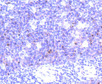 Aurora B Recombinant Rabbit Monoclonal Antibody