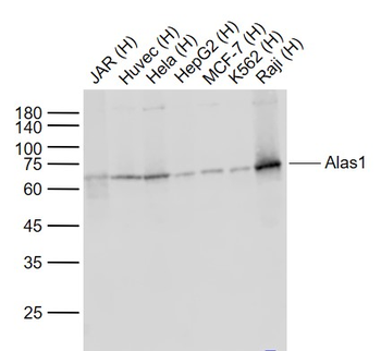 Alas1 Recombinant Rabbit Monoclonal Antibody