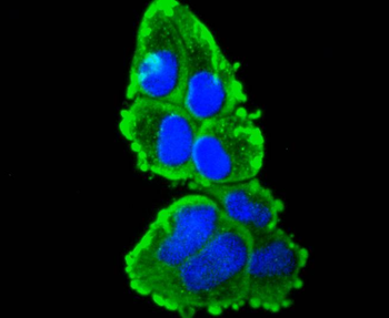 Cytokeratin 16 Recombinant Rabbit Monoclonal Antibody