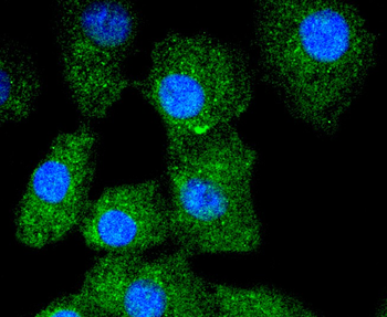 Cytokeratin 13 Recombinant Rabbit Monoclonal Antibody