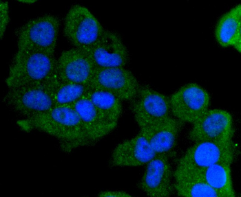 Cytokeratin 13 Recombinant Rabbit Monoclonal Antibody