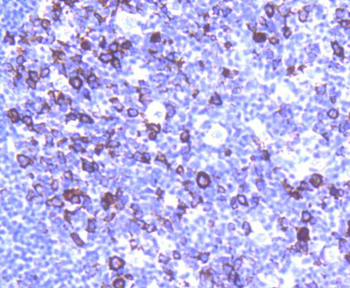 Cyclin B1 Recombinant Rabbit Monoclonal Antibody
