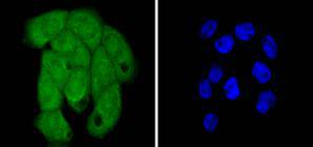 Histone H2B Recombinant Rabbit Monoclonal Antibody