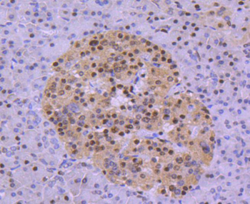 HDAC8 Recombinant Rabbit Monoclonal Antibody