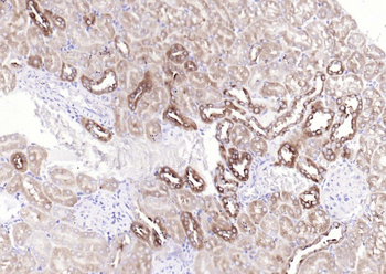 Phospho-Glycogen synthase 1 (Ser641) Recombinant Rabbit Monoclonal Antibody