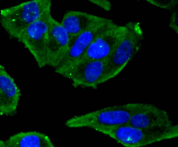 Phospho-Estrogen Receptor alpha (Ser118) Recombinant Rabbit Monoclonal Antibody
