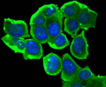 Phospho-Estrogen Receptor alpha (Ser118) Recombinant Rabbit Monoclonal Antibody