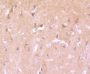 Phospho-PKC alpha (Thr638) Recombinant Rabbit Monoclonal Antibody