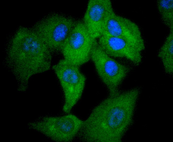 STAT2 Recombinant Rabbit Monoclonal Antibody