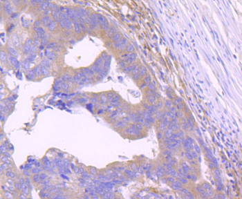STAT2 Recombinant Rabbit Monoclonal Antibody