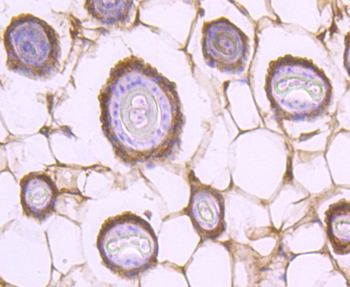 STAT2 Recombinant Rabbit Monoclonal Antibody