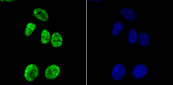 Histone H3 (acetyl K14) Recombinant Rabbit Monoclonal Antibody