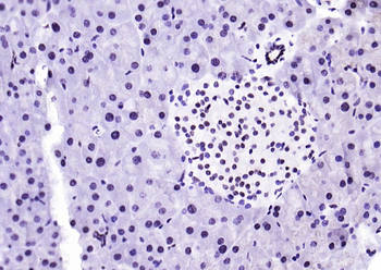 Phospho-STAT1 (Ser727) Recombinant Rabbit Monoclonal Antibody