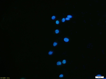 HDAC2 Recombinant Rabbit Monoclonal Antibody