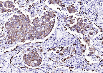 CK7 Recombinant Rabbit Monoclonal Antibody