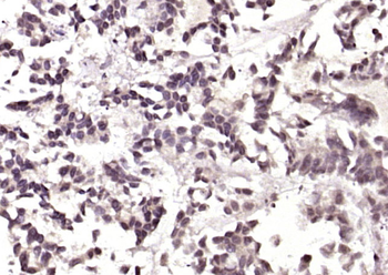 S100P Rabbit Polyclonal Antibody