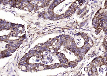RhoA Rabbit Polyclonal Antibody