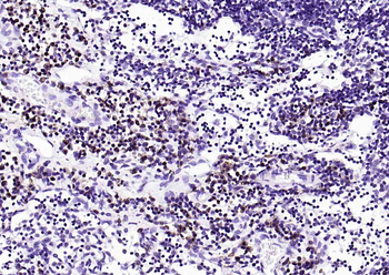 CD7 Rabbit Polyclonal Antibody