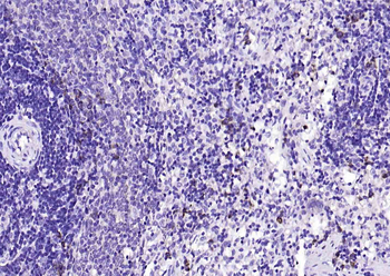 CD7 Rabbit Polyclonal Antibody