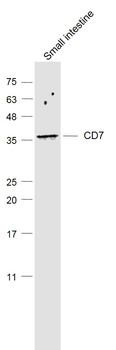 CD7 Rabbit Polyclonal Antibody