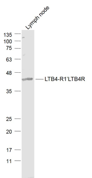 LTB4-R1/LTB4R Rabbit Polyclonal Antibody