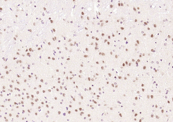 BNC1 Rabbit Polyclonal Antibody