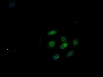 YAP1 Rabbit Polyclonal Antibody