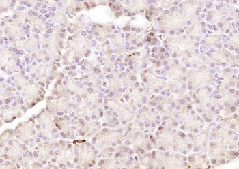 Phospho-eIF4EBP1 (Ser64) Rabbit Polyclonal Antibody