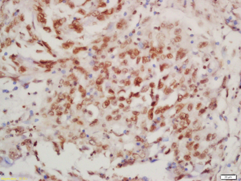 Phospho-BTK (Tyr223) Rabbit Polyclonal Antibody