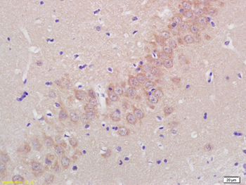 ADAMTS5 Rabbit Polyclonal Antibody