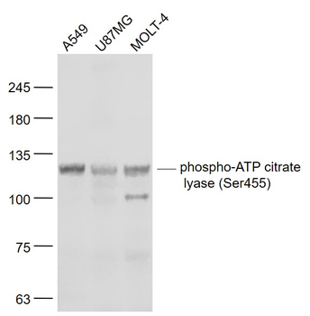 Phospho-ACLY (Ser455) Rabbit Polyclonal Antibody