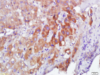 Calmodulin 1/2/3 Rabbit Polyclonal Antibody