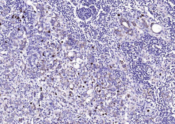 CD134 Rabbit Polyclonal Antibody