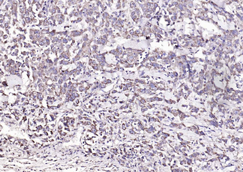 CD134 Rabbit Polyclonal Antibody