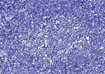 CD134 Rabbit Polyclonal Antibody