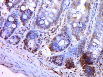 Cdc25A Rabbit Polyclonal Antibody