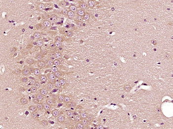 TSPO/PBR Rabbit Polyclonal Antibody