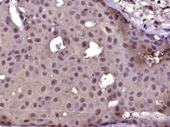 Phospho-A Raf (Ser214) Rabbit Polyclonal Antibody