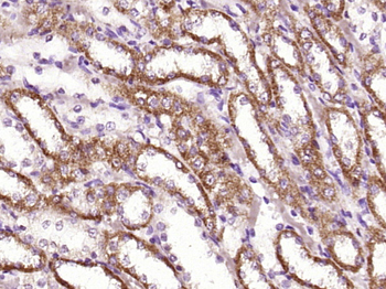 DPP1 Rabbit Polyclonal Antibody