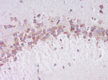 Phospho-Dab1 (Ser491) Rabbit Polyclonal Antibody
