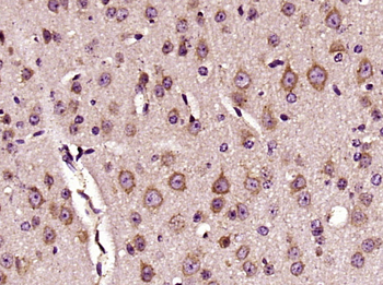 DKK3 Rabbit Polyclonal Antibody