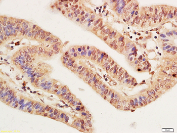 EZH2 Antibody