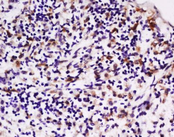 LPA2 Rabbit Polyclonal Antibody
