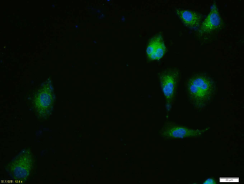 ERK1 + ERK2 Rabbit Polyclonal Antibody