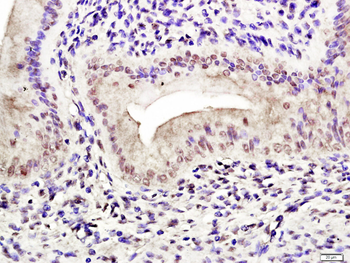 Phospho-Estrogen Receptor alpha (Ser118) Rabbit Polyclonal Antibody