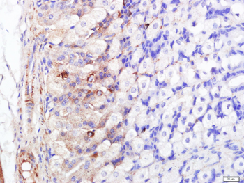FABP5 Rabbit Polyclonal Antibody